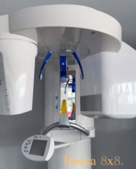 Ціну знижено +розтермінування на 3місяці! 3D Томограф! SIRONA ORTHOPHOS. XG. Рамка 8х8. Повноцінний захват Zooble.com.ua