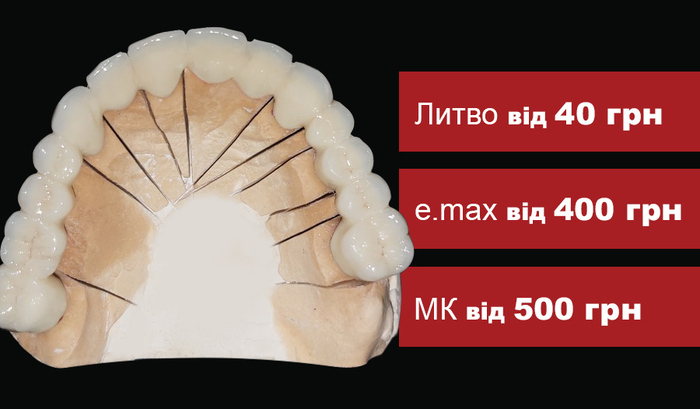 Усі види зуботехнічних і ливарних робіт для стоматологів і зубних техніків! Працюємо по Україні через Нову пошту. Zooble.com.ua