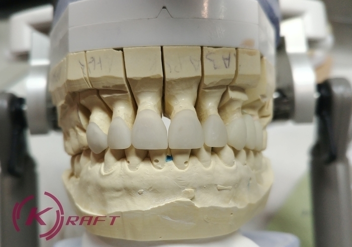 Зуботехническая лаборатория предлагает услуги для стоматологов и зубных техников Zooble.com.ua
