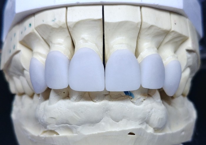 Зуботехническая лаборатория предлагает услуги для стоматологов и зубных техников Zooble.com.ua