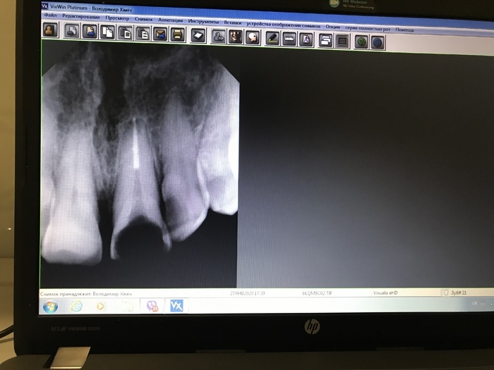 Визиограф стоматологический Gendex Visualix eHd... Zooble.com.ua