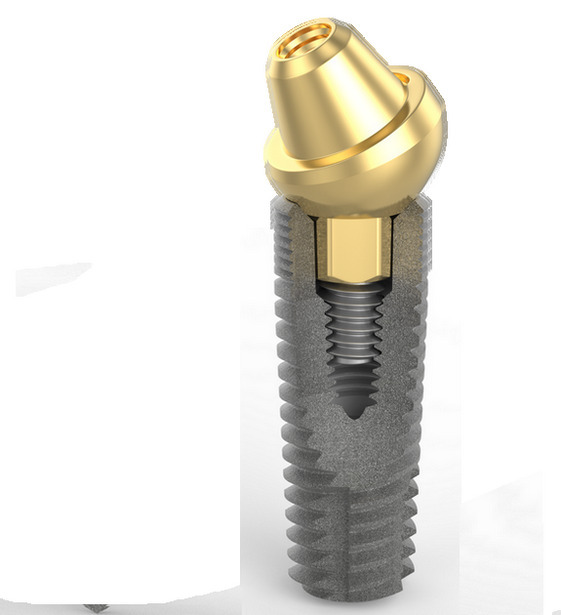Зубні імплантати TOV IMPLANT (Ізраїль) Найвища якість за помірну ціну! Zooble.com.ua