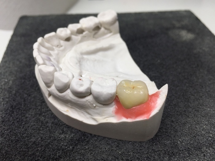 Зубний технік шукає для співпраці лікаря стоматолога Zooble.com.ua