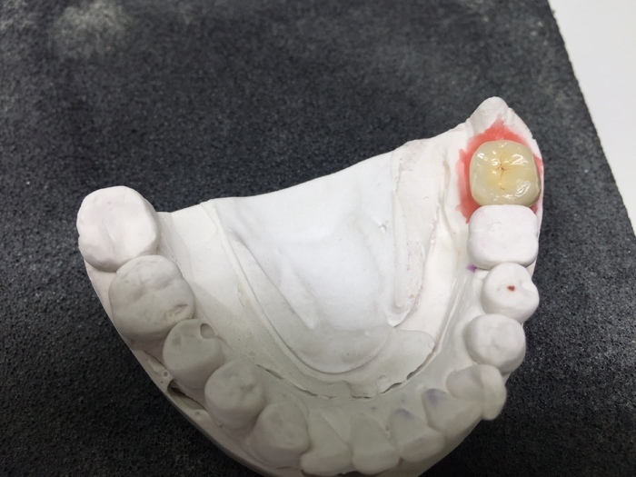 Зубний технік шукає для співпраці лікаря стоматолога Zooble.com.ua