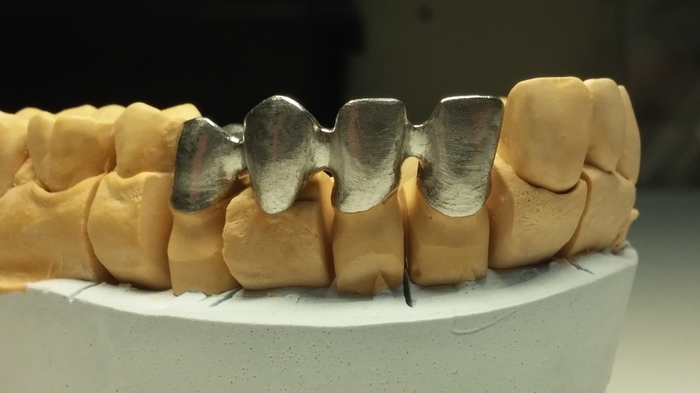 Зуботехническая лаборатория по изготовлению металических каркасов приглашает к сотрудничеству зубных техников Zooble.com.ua