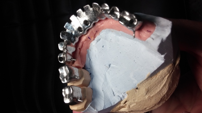 Зуботехническая лаборатория по изготовлению металических каркасов приглашает к сотрудничеству зубных техников Zooble.com.ua