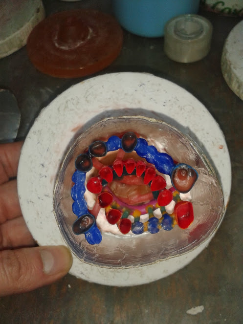 Зуботехнічна лабораторія (ливарня), виготовлення зубних протезів. Zooble.com.ua