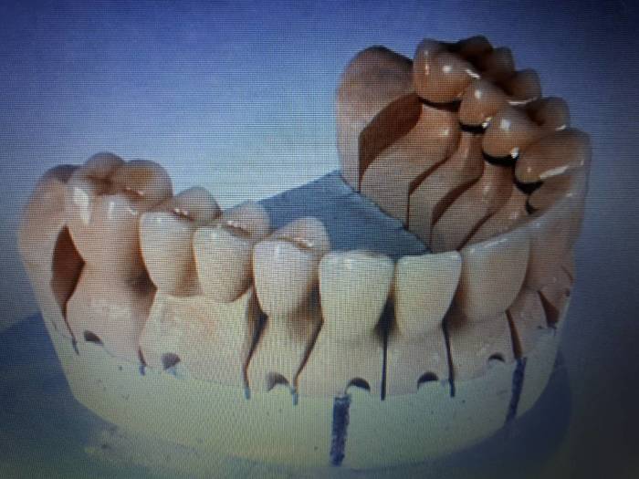 Зуботехнічна лабораторія запрошує до співпраці лікарів стоматологів та стомат. кабінети. Одна одиниця МК - 500 грн. Zooble.com.ua